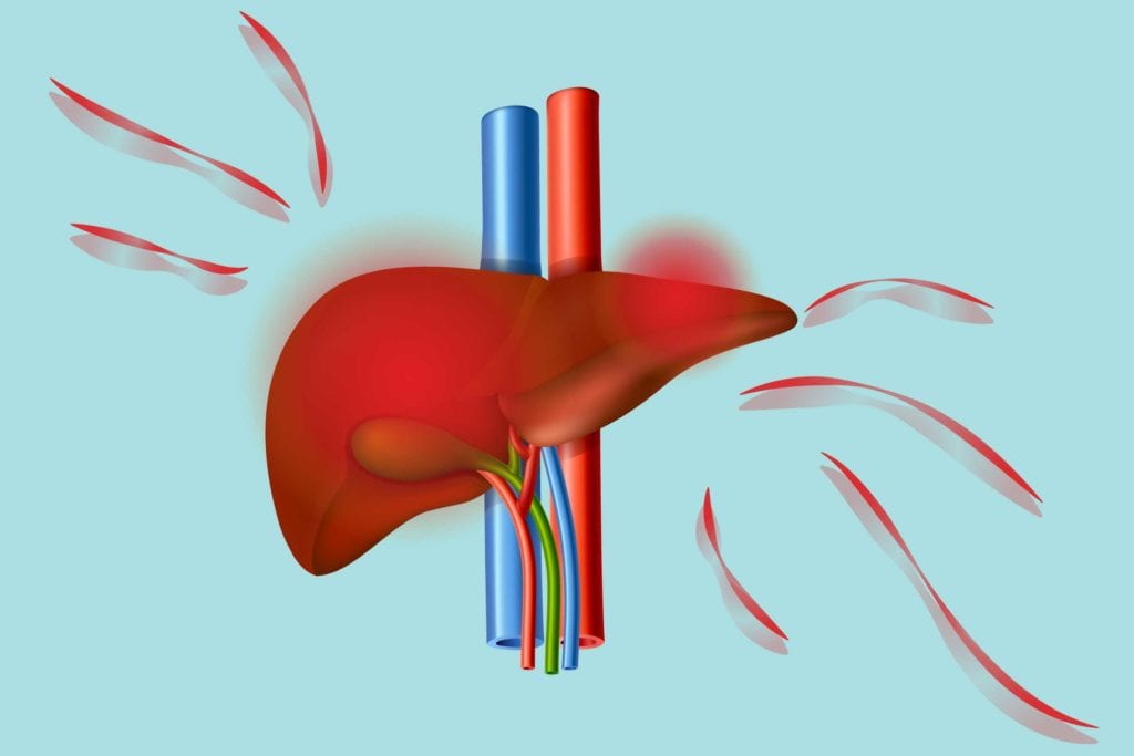 Fatty Liver and Arthritis