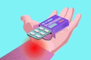 Prednisolone Helps Treat Hand OA