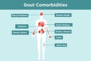 Gout Comorbidities Infographic