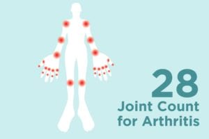 28 Joint Count Test for Arthritis