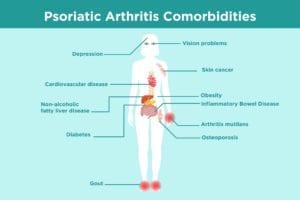 Psoriatic Arthritis Comorbidities