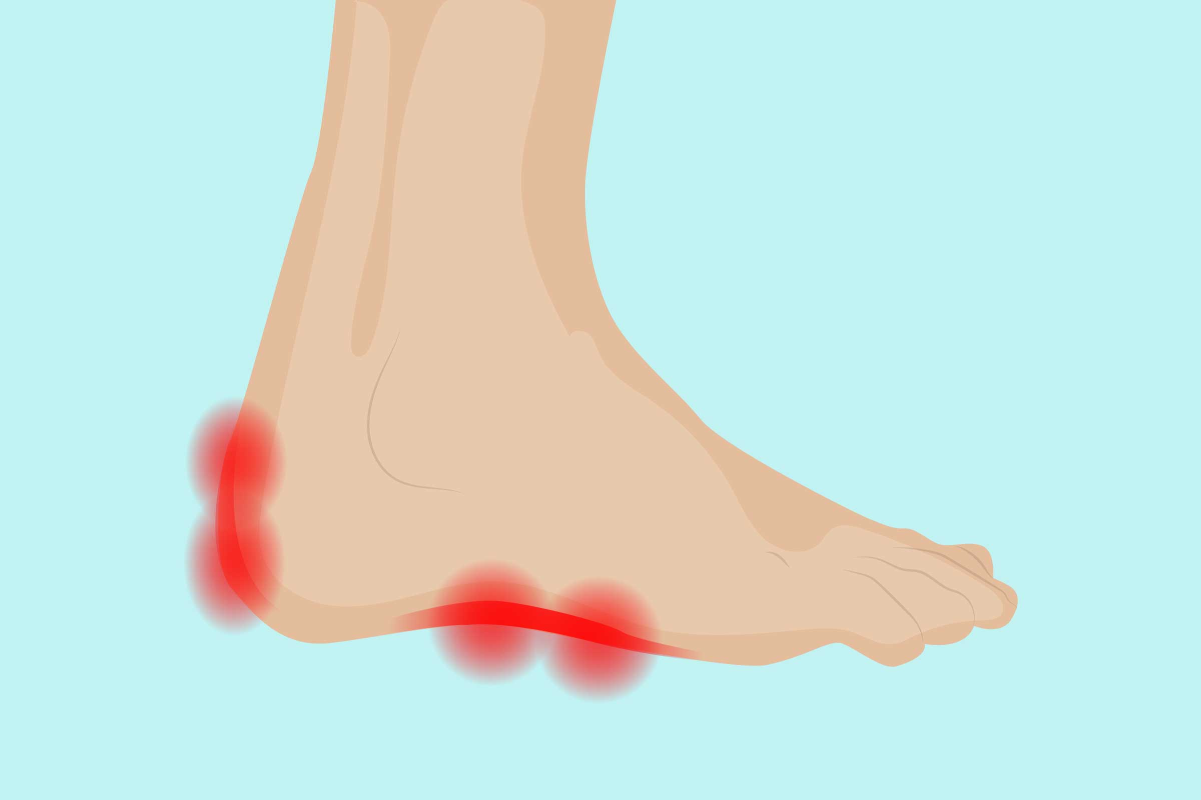 Inflammation on bottom hot sale of foot