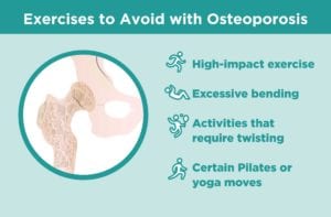 Exercises to Avoid Osteoporosis