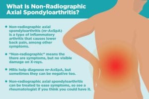 Non Radiographic Axial Spondyloarthritis (nr-AxSpA)