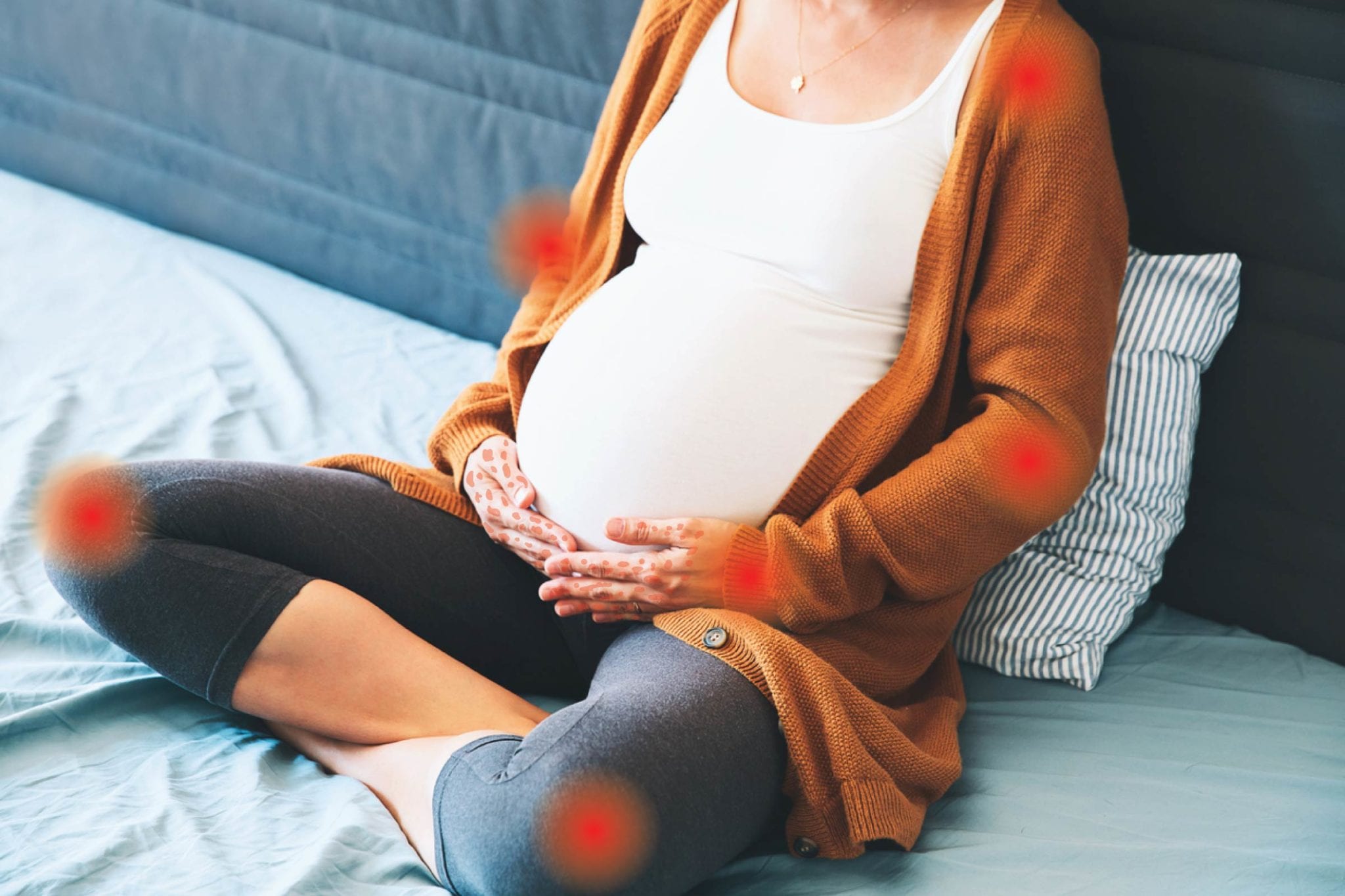 psoriasis remission during pregnancy