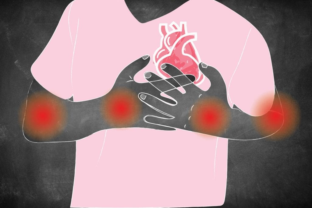 psoriasis heart disease vörös foltok és repedések kezén