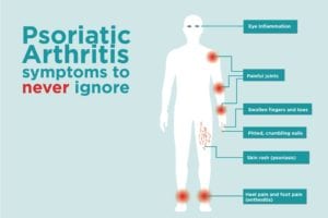 Féle psoriasis a test