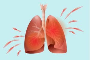 How Arthritis Affects the Lungs