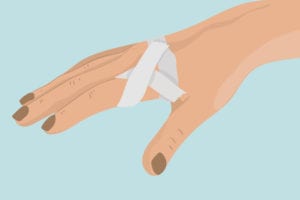 Tips for Managing Hand Arthritis