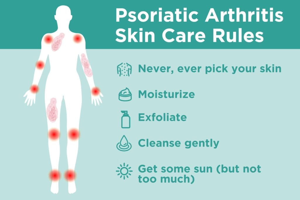 Psoriatic Arthritis: Symptoms and Treatments