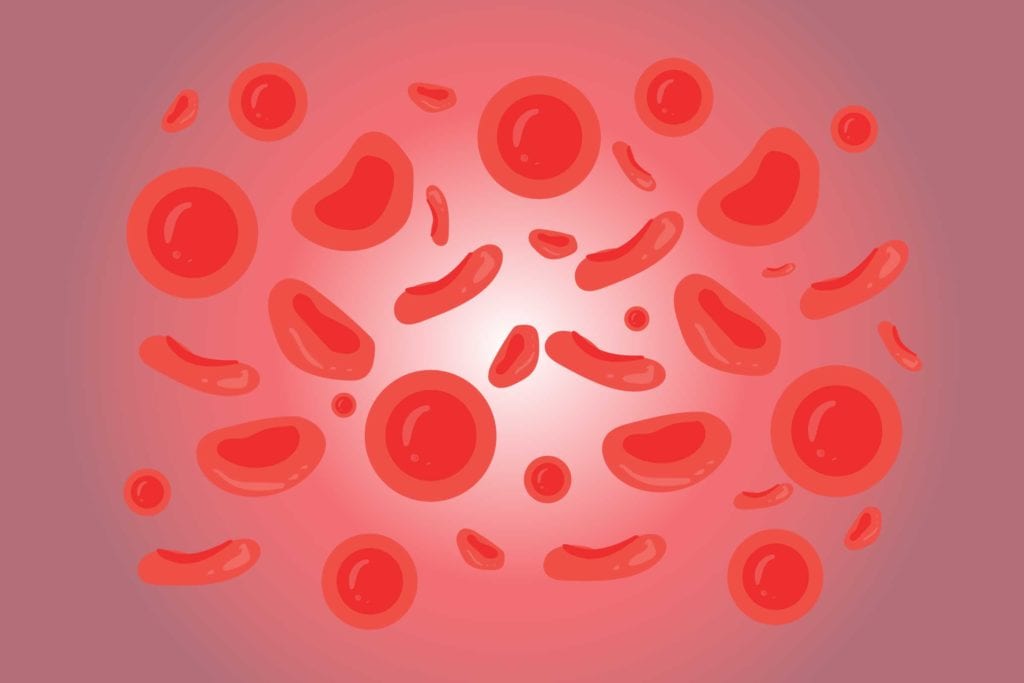 Anemia and Rheumatoid Arthritis