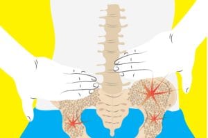 Osteoporosis in the Hip