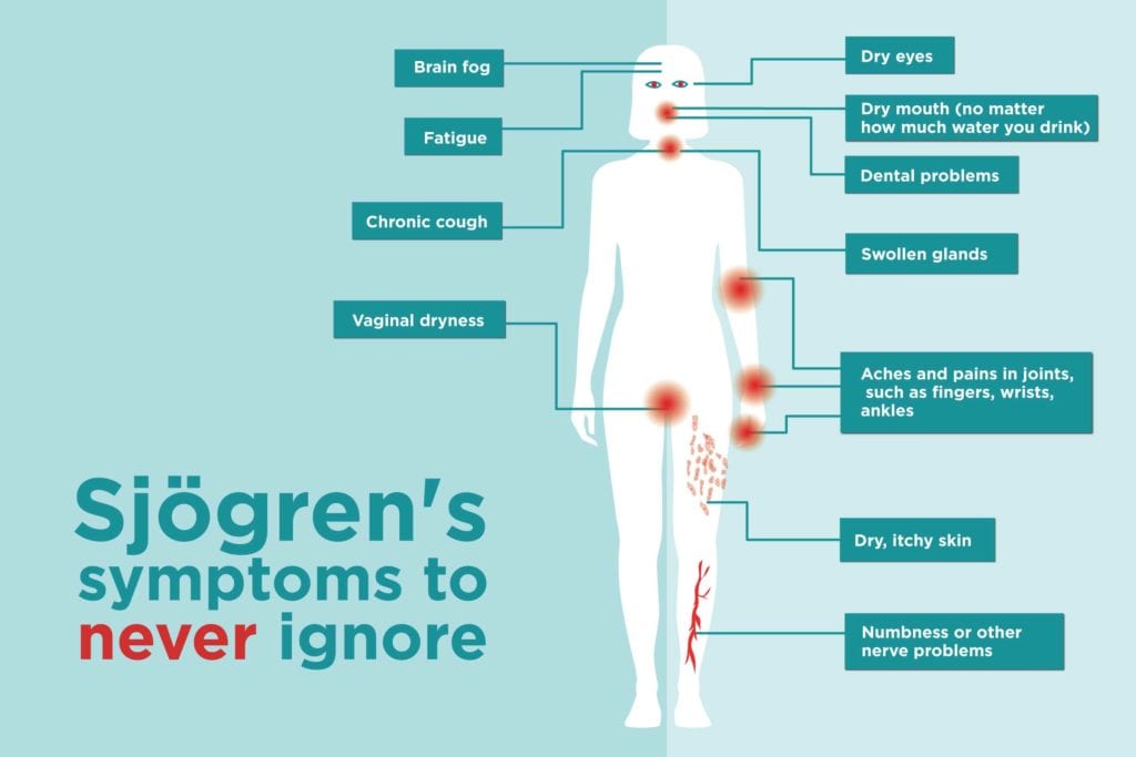Sjogren's Syndrome Symptoms