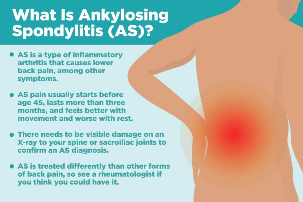What is ankylosing spondylitis?