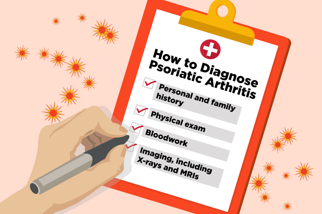 Diagnosing Psoriatic Arthritis