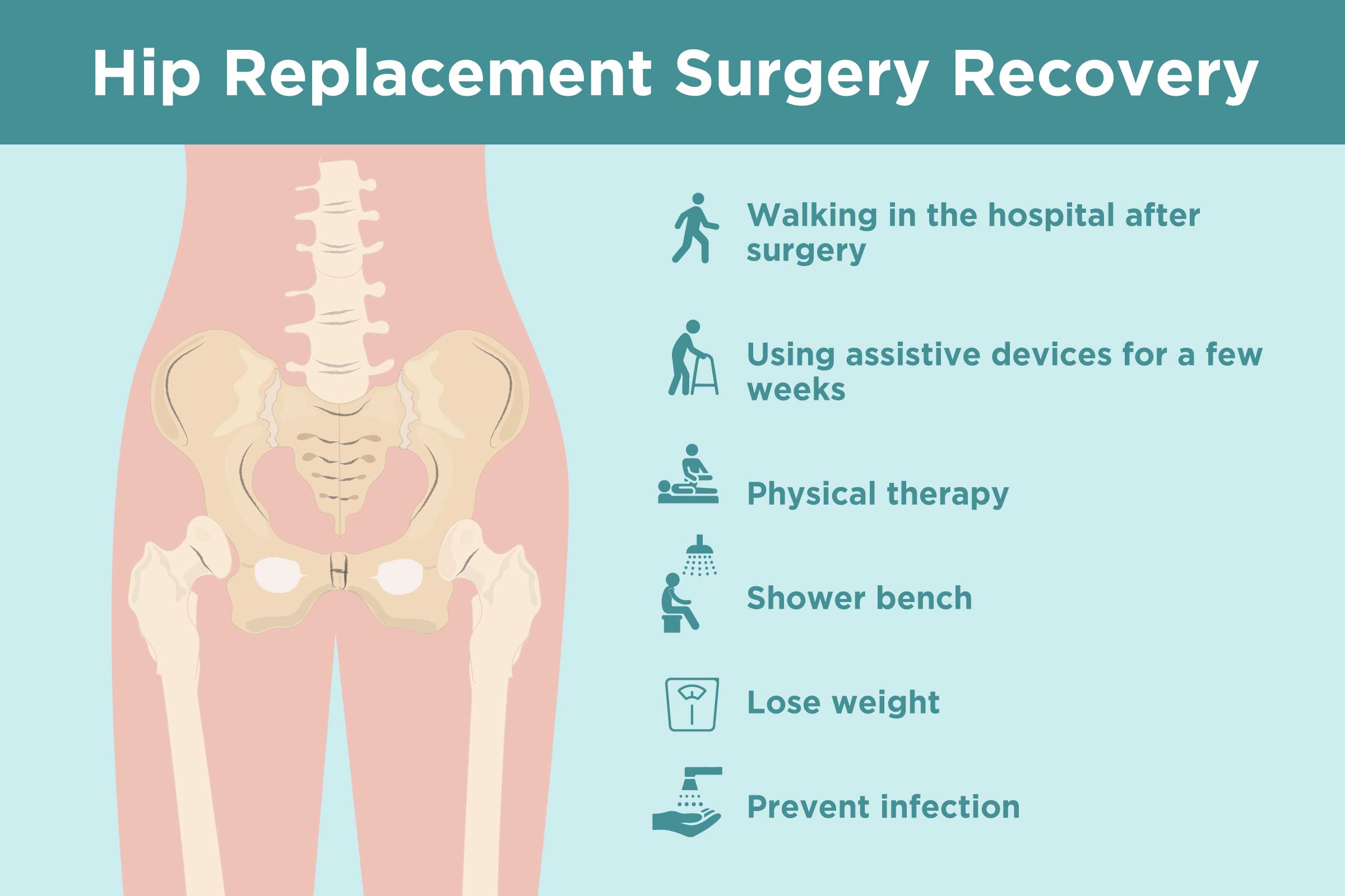 What Is The Average Recovery Time For A Total Hip Replacement