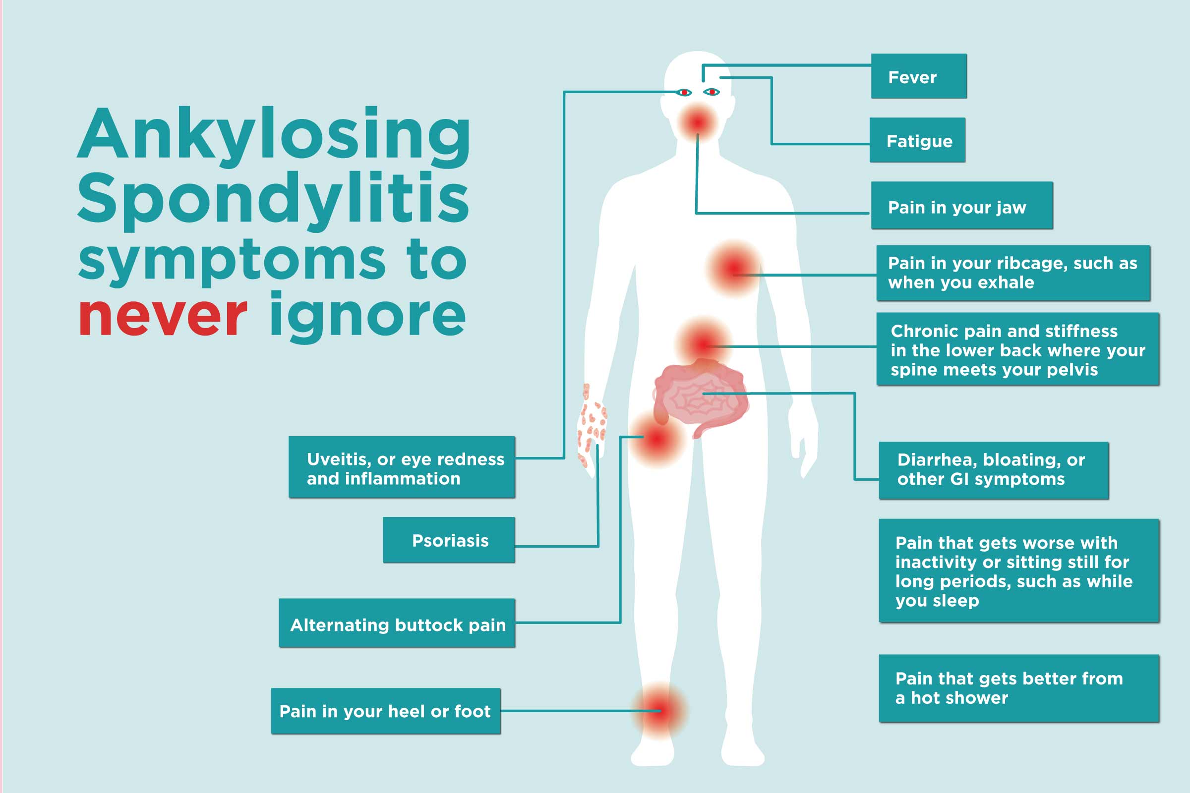 Common Ankylosing Spondylitis Signs and Symptoms