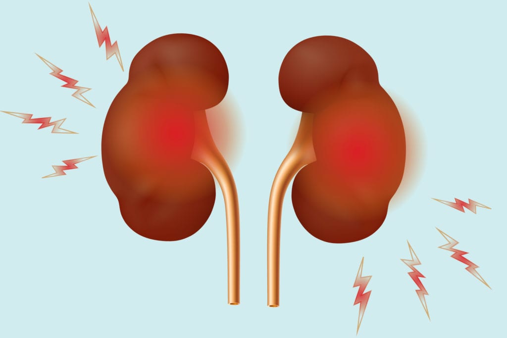 kidney-health-the-basics-el-camino-health