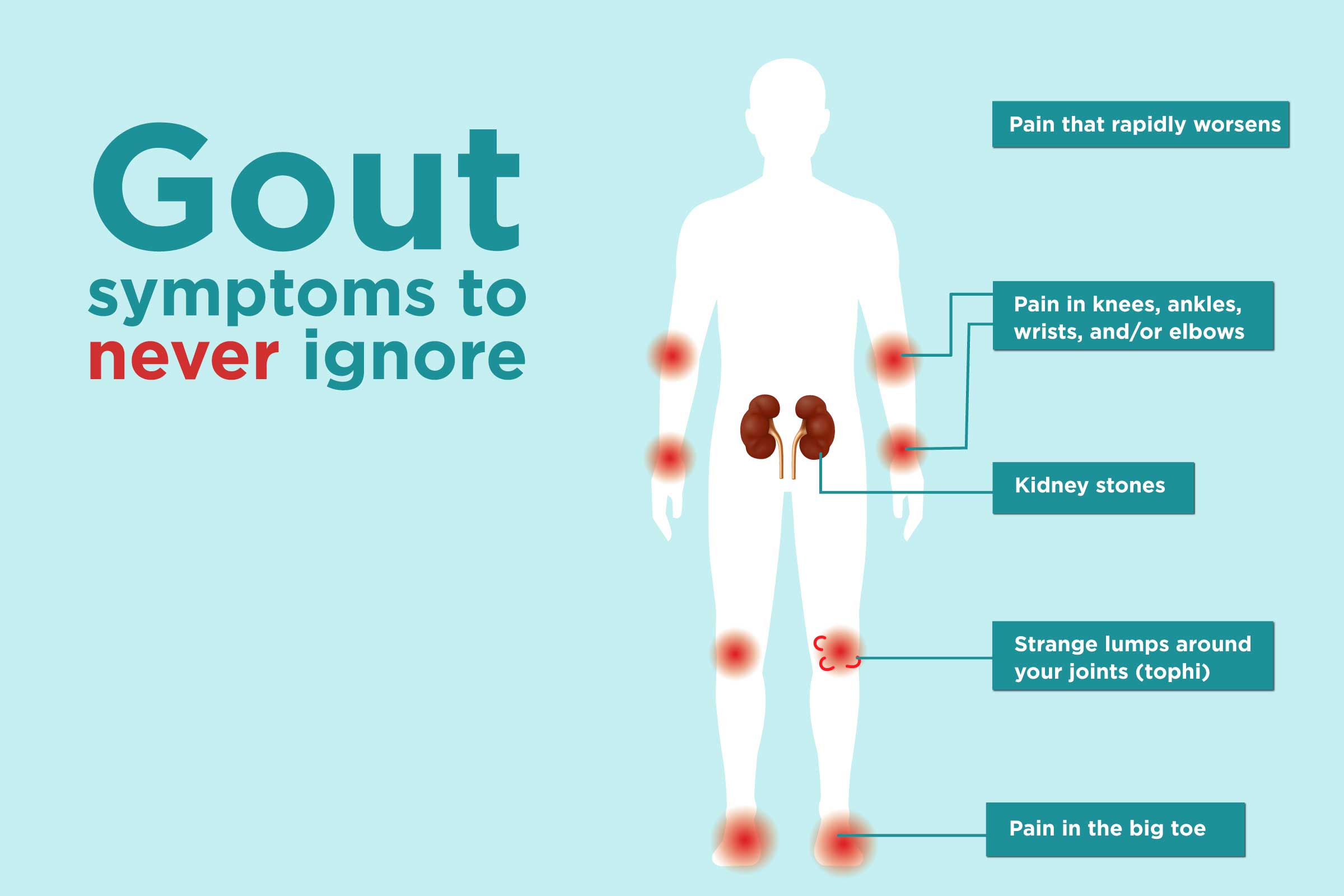 Gout Symptoms You Might Be Ignoring CreakyJoints