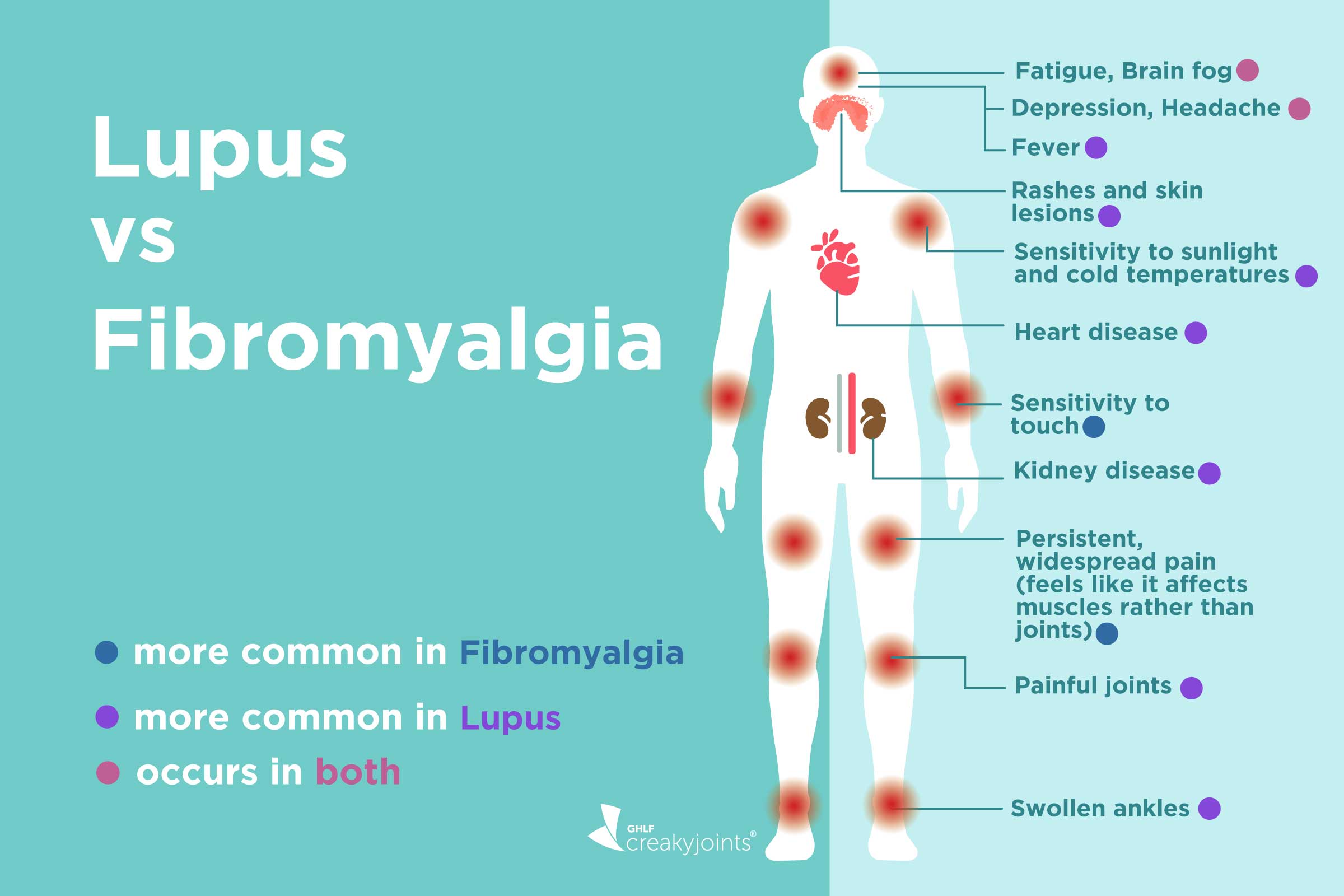 Fibromyalgia vs. Lupus: What's the Difference?