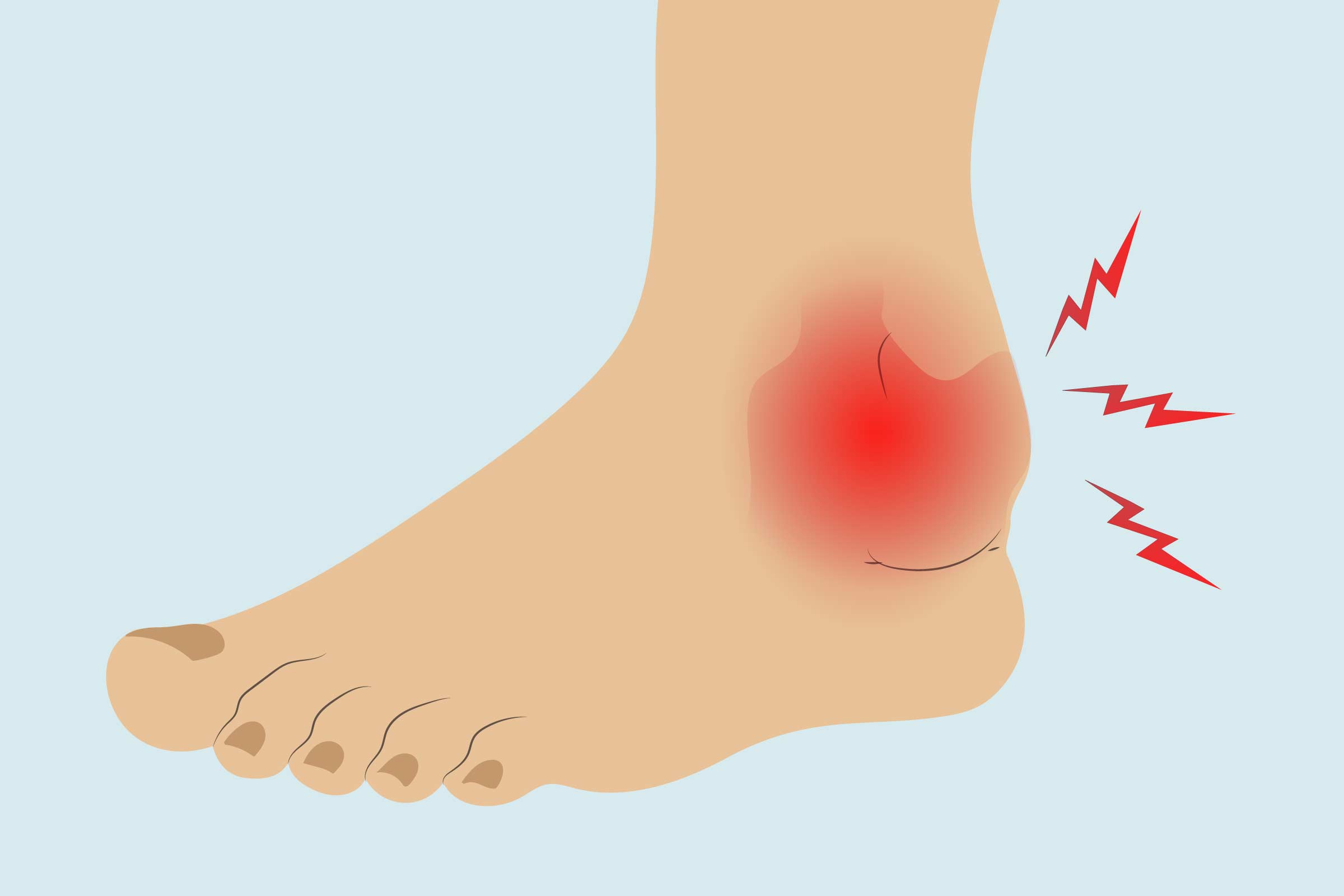 heel pain with ankle swelling