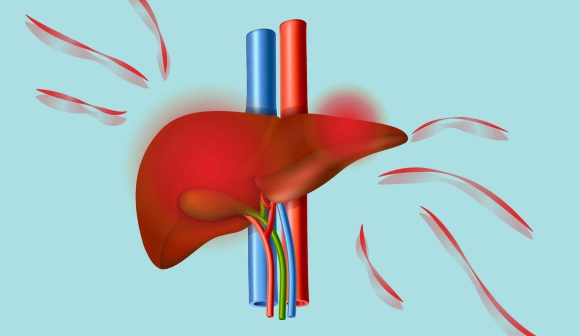 Fatty Liver and Arthritis