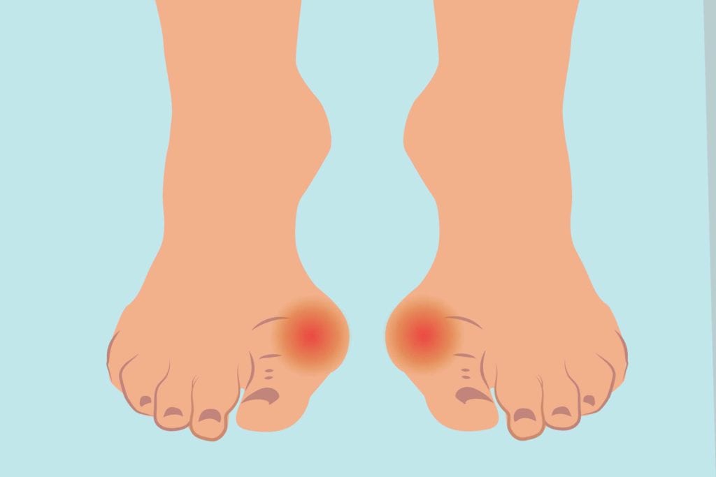 What Pain in the Arch of Your Foot Means | The Good Feet Store