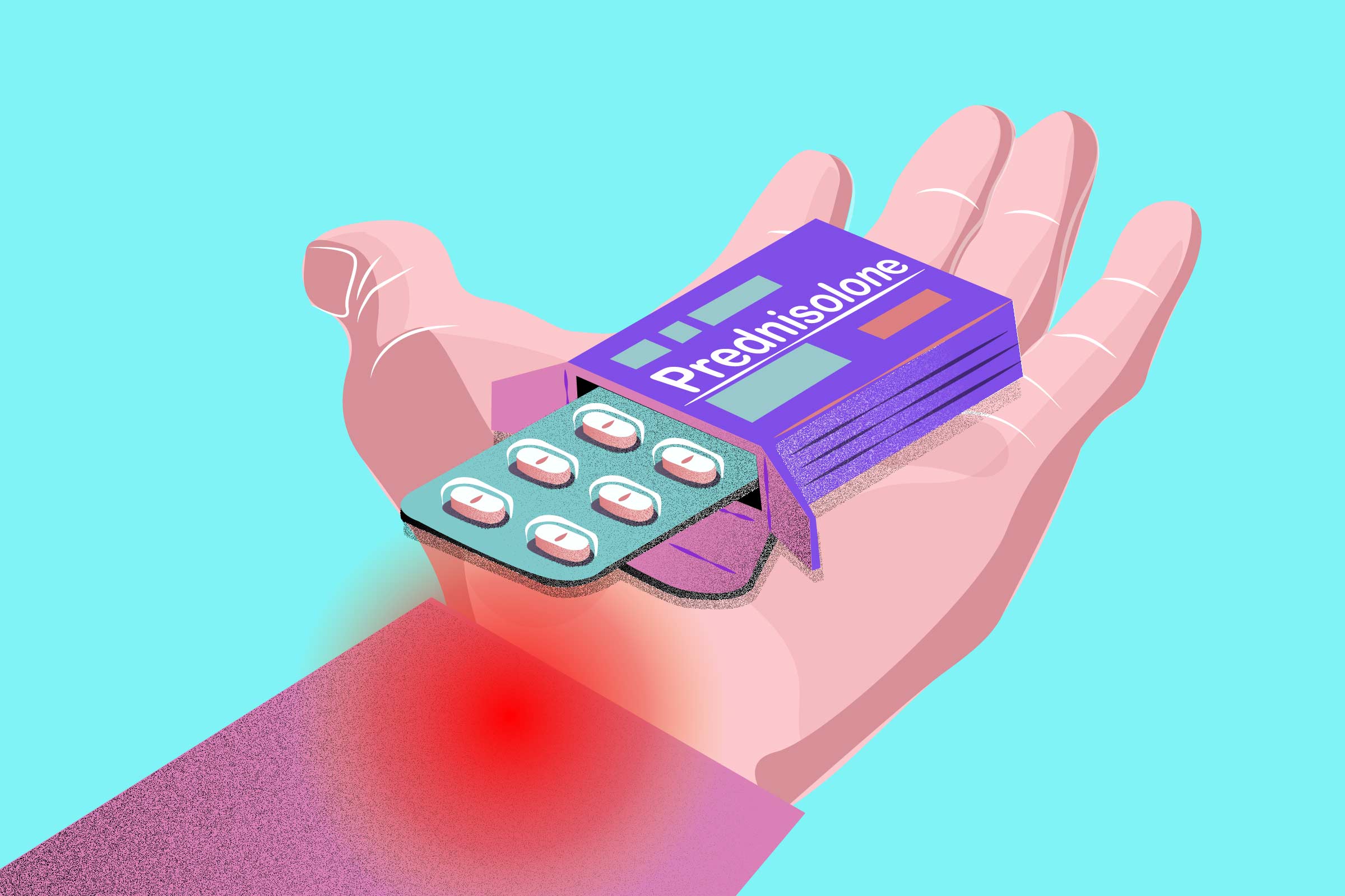 corticosteroids