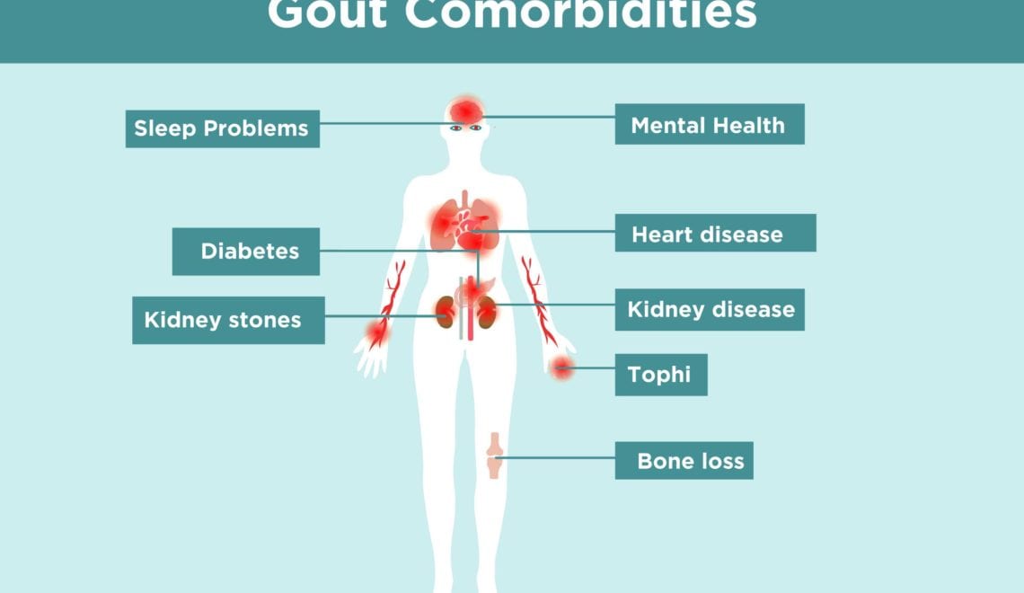 Gout Comorbidities Infographic