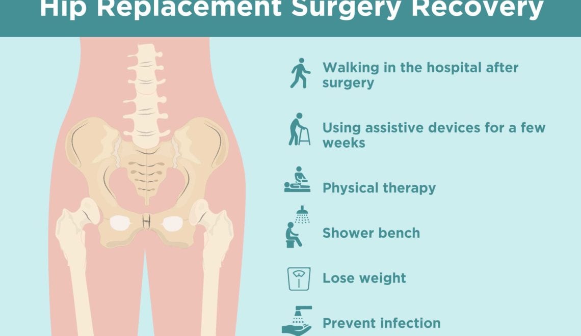 Hip Replacement Surgery Recovery