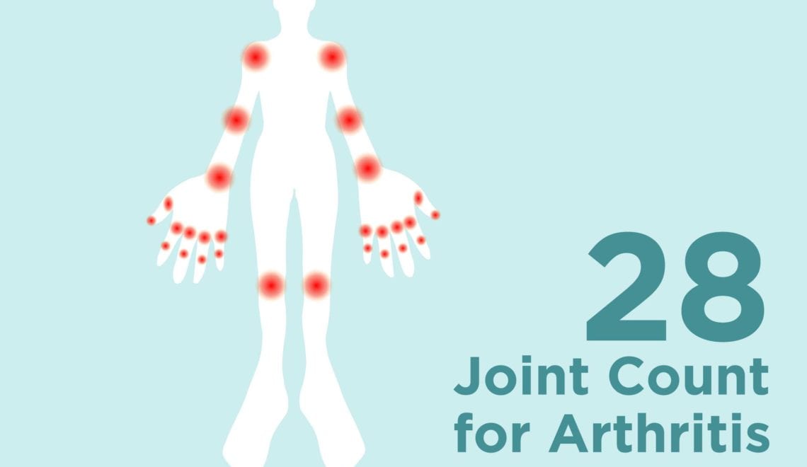 28 Joint Count Test for Arthritis image