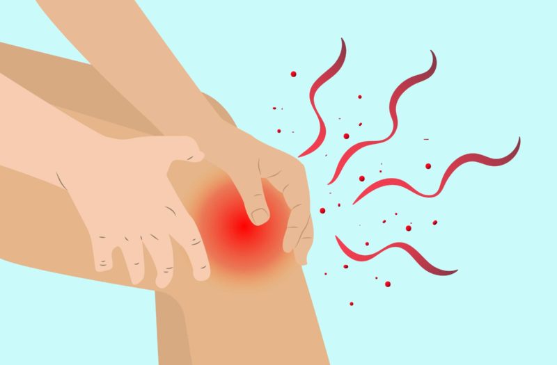 Arthritis Knee Pain