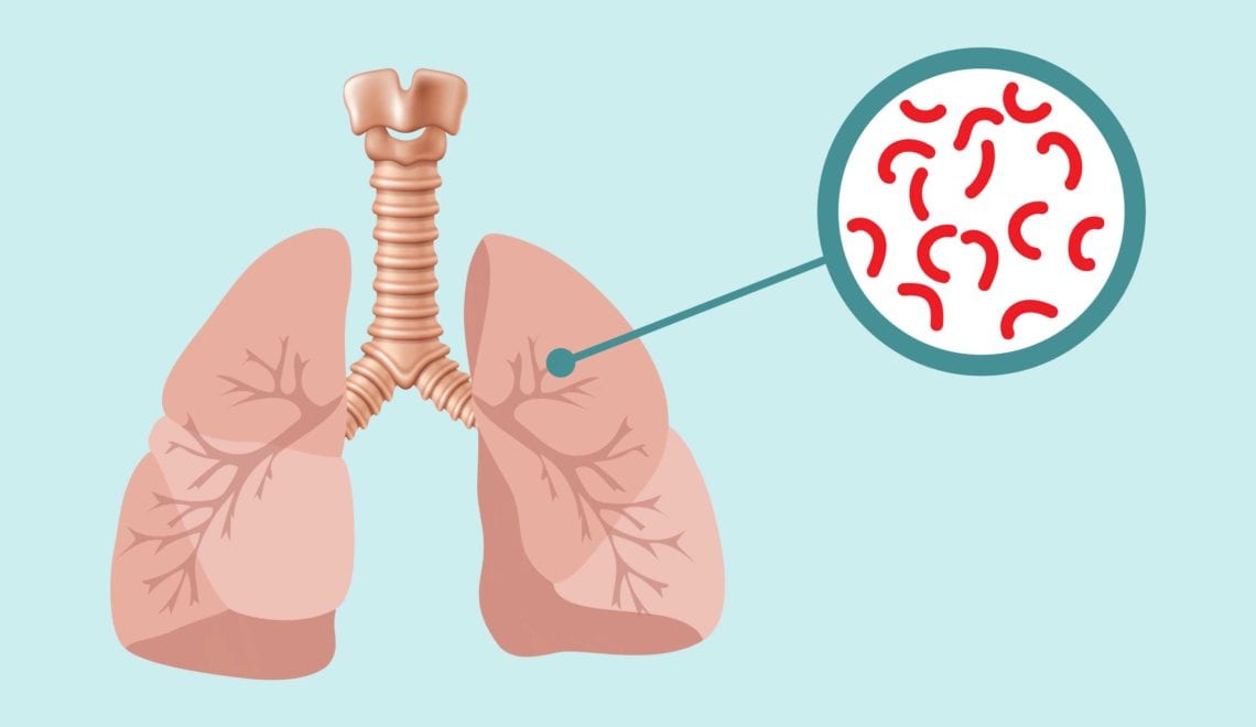 Tuberculosis and Arthritis