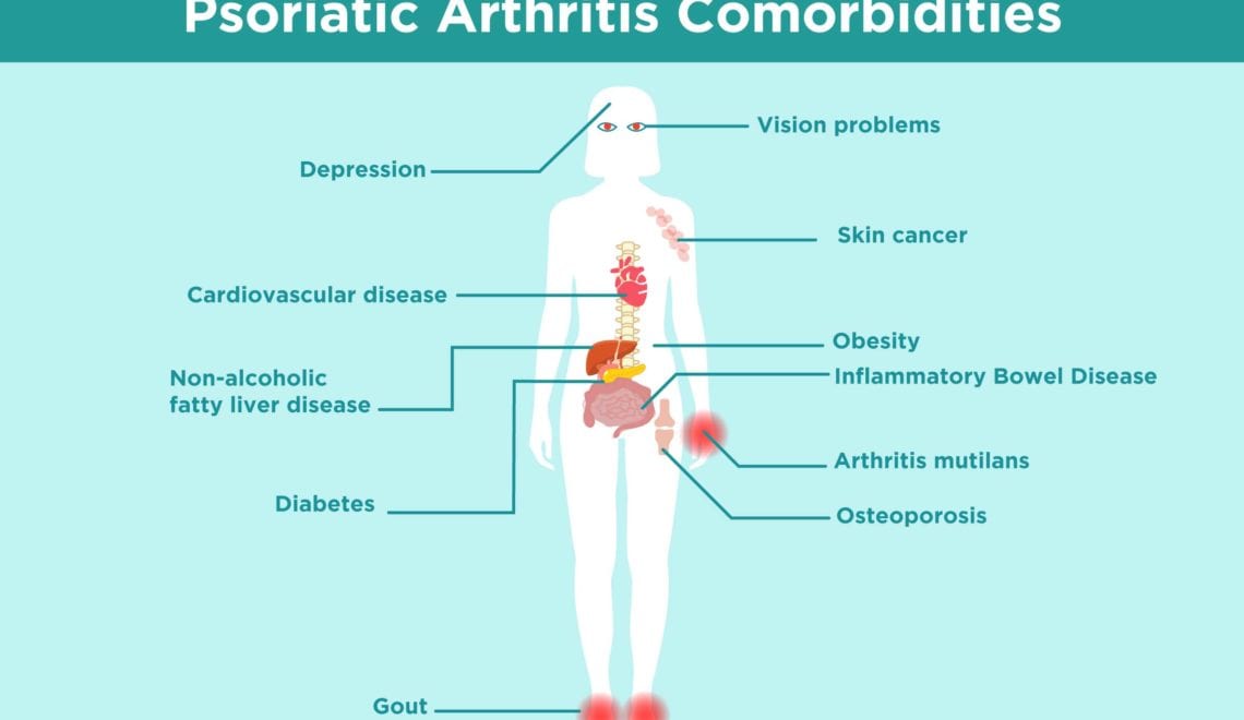 Psoriatic Arthritis Comorbidities