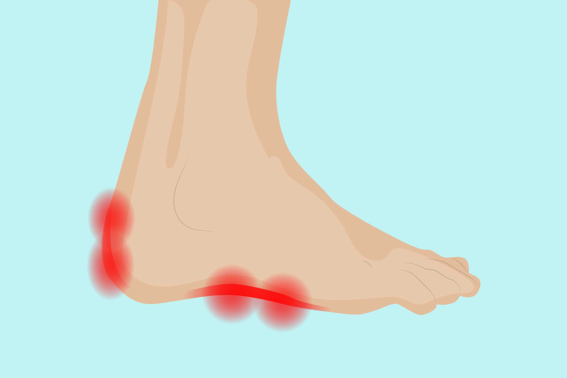 inflammation in the foot sole