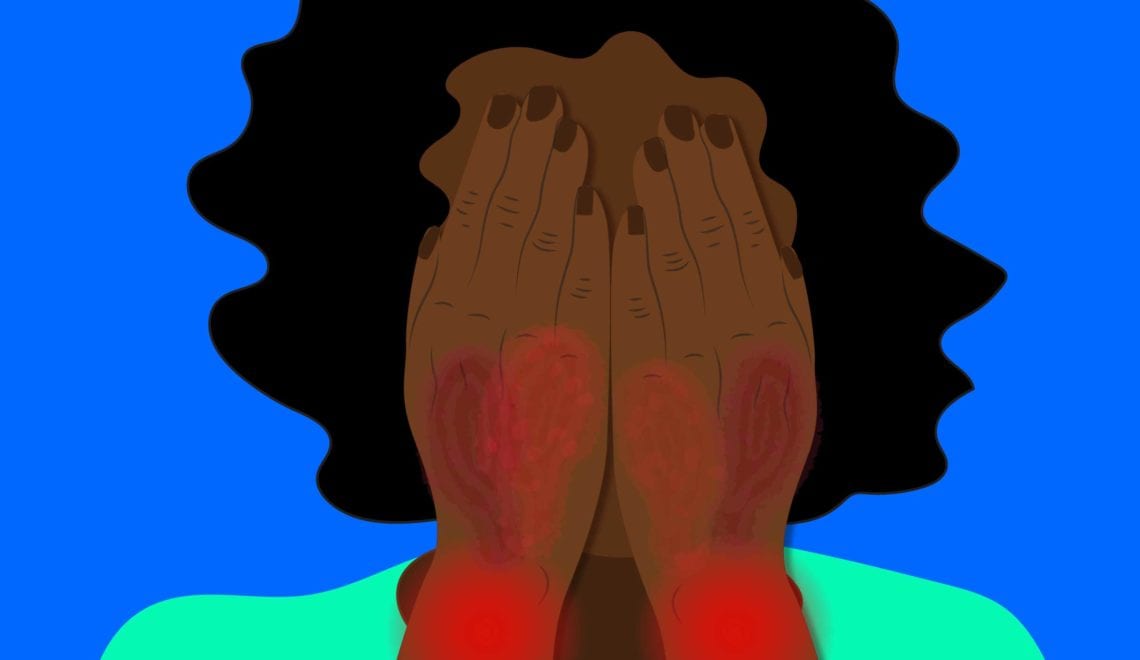 An illustration of a woman of color covering her face with her hands. Her hands are red and scabby due to psoriatic arthritis.