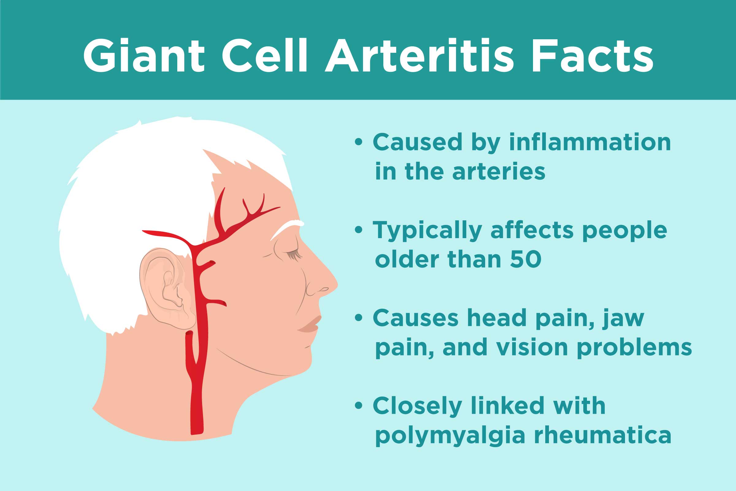 What Is Giant Cell Arteritis? Symptoms, Causes, Treatments