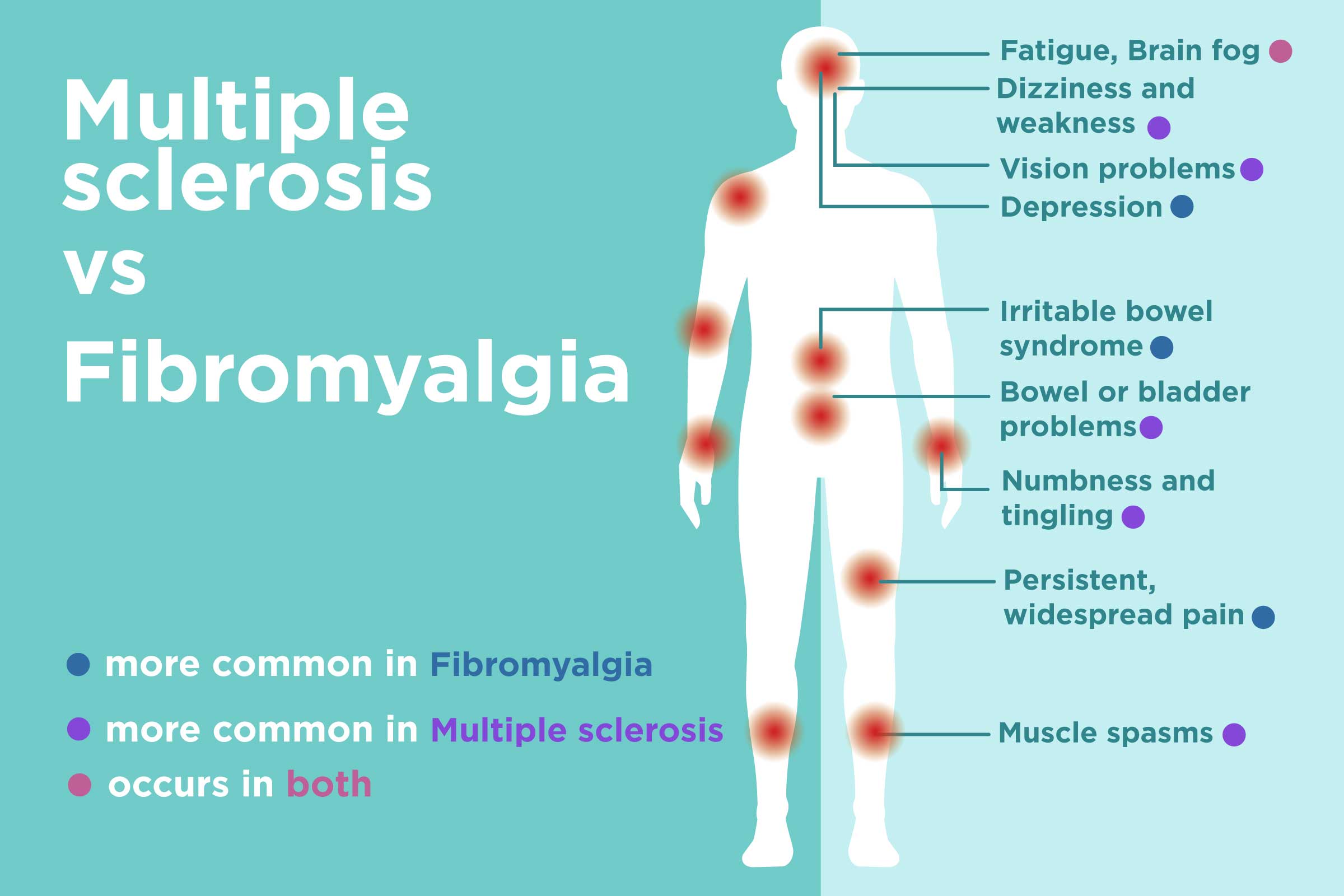 Fibromyalgia vs. Multiple Sclerosis (MS): Differences in Signs ...
