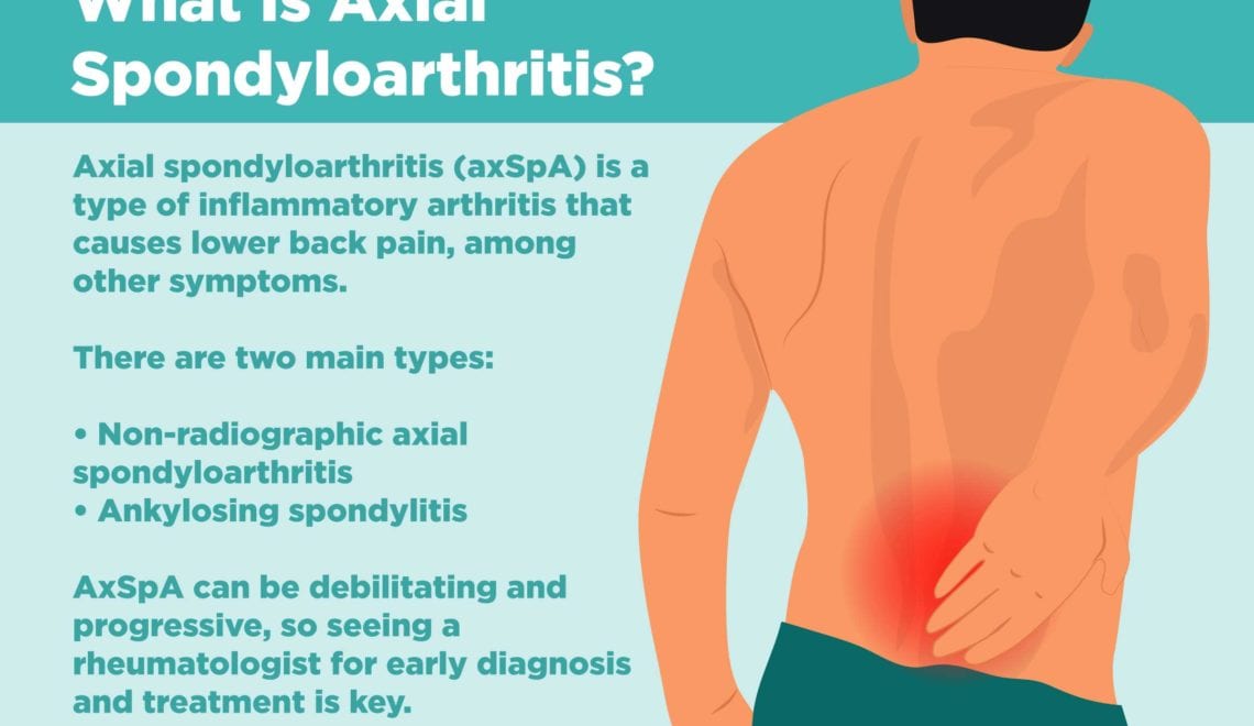 Axial Spondyloarthritis