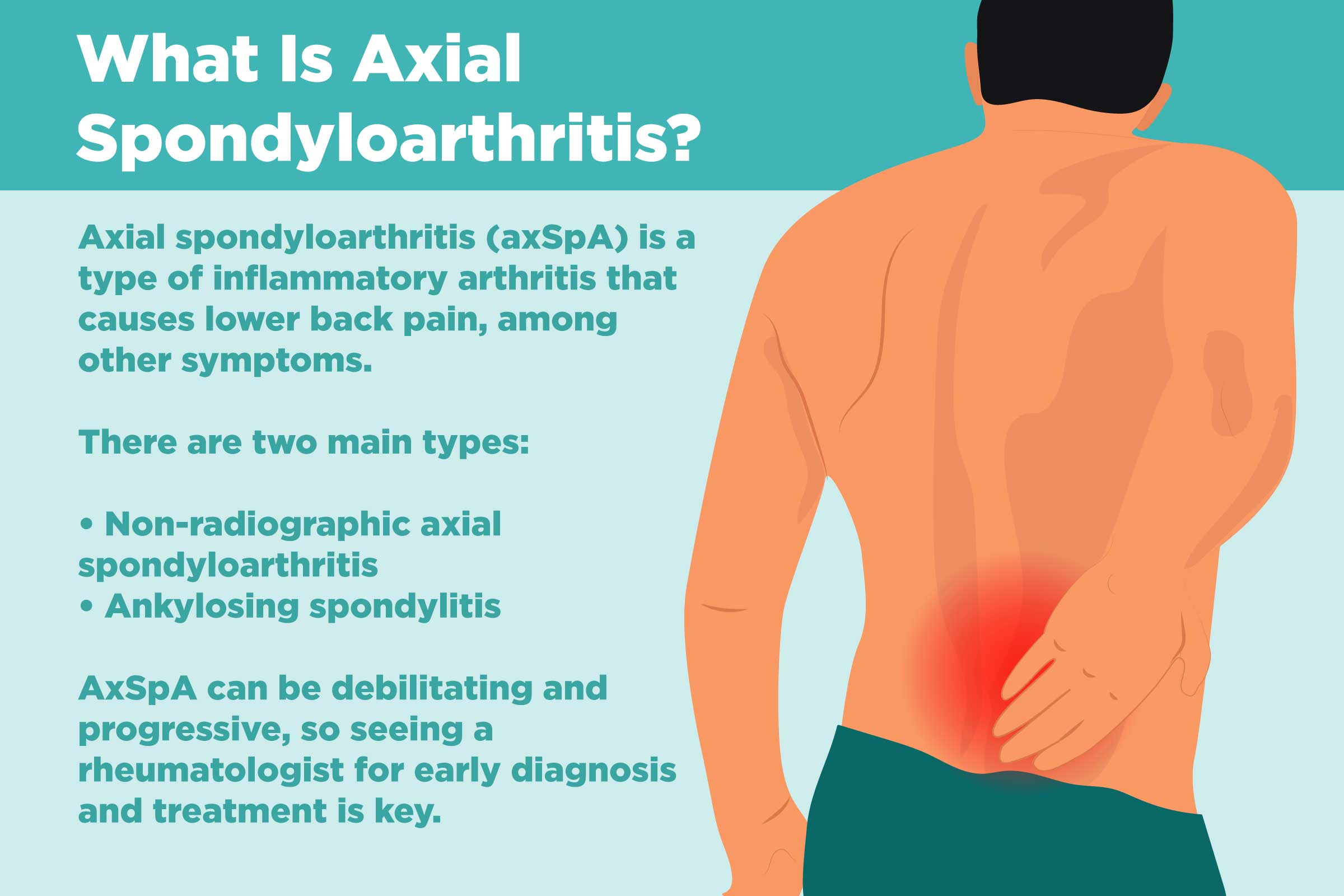 spondyloarthritis