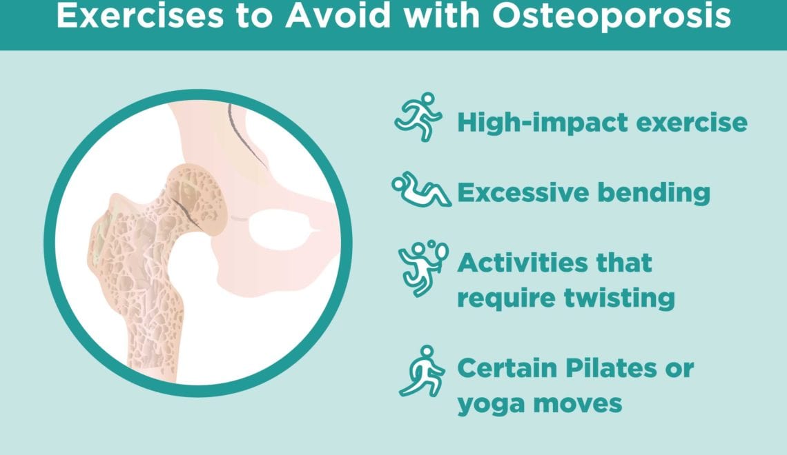 Exercises to Avoid Osteoporosis