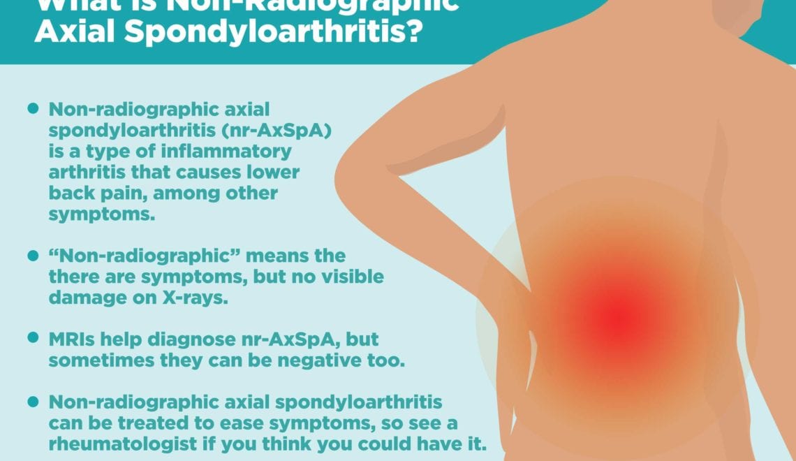 Non Radiographic Axial Spondyloarthritis