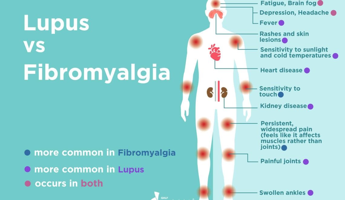 Lupus Vs Fibromyalgia infographic