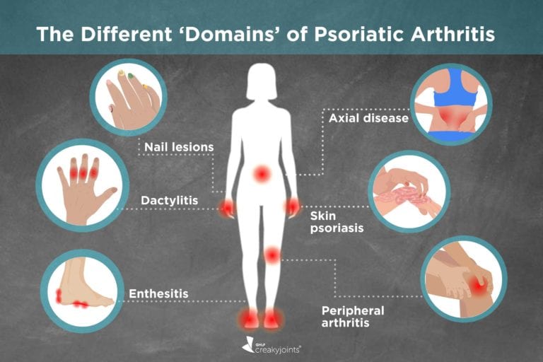 Different Types Of Psoriatic Arthritis Symptoms Treatments Outcomes   1019 Psoriatic Arthritis Types Logo 768x512 