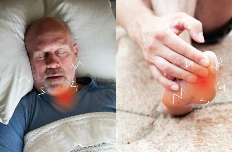 Sleep Apnea and Gout