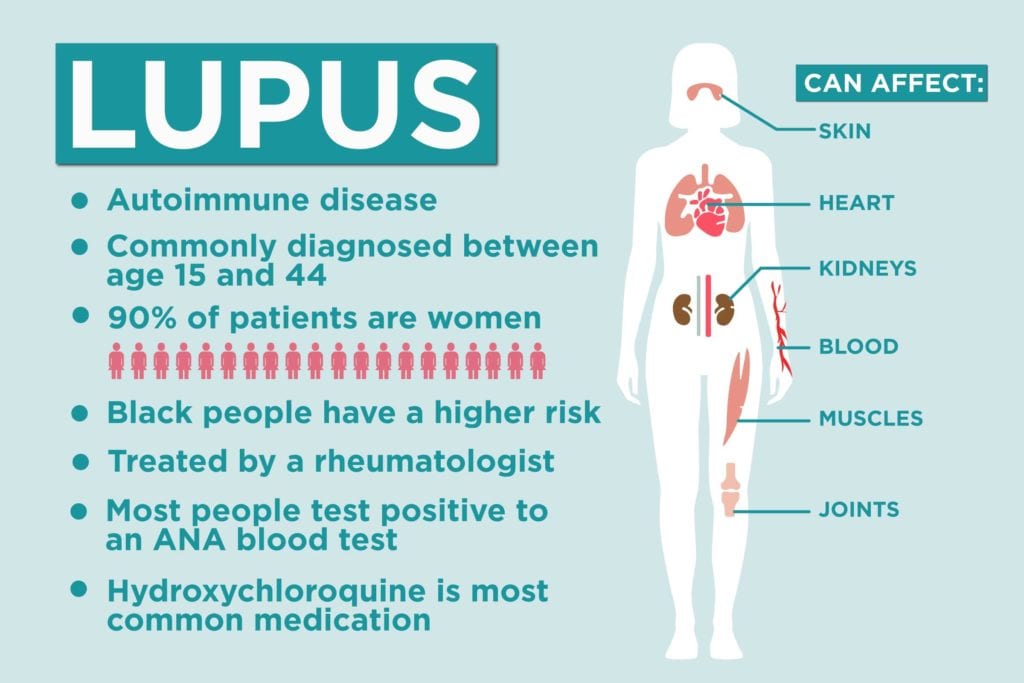 Lupus Points Chart