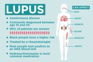 Lupus Facts 17 Things To Know About Lupus