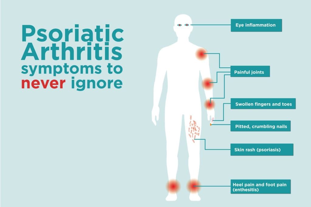 psoriatic-arthritis-signs-and-symptoms