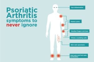 is psoriatic arthritis an inflammatory disease
