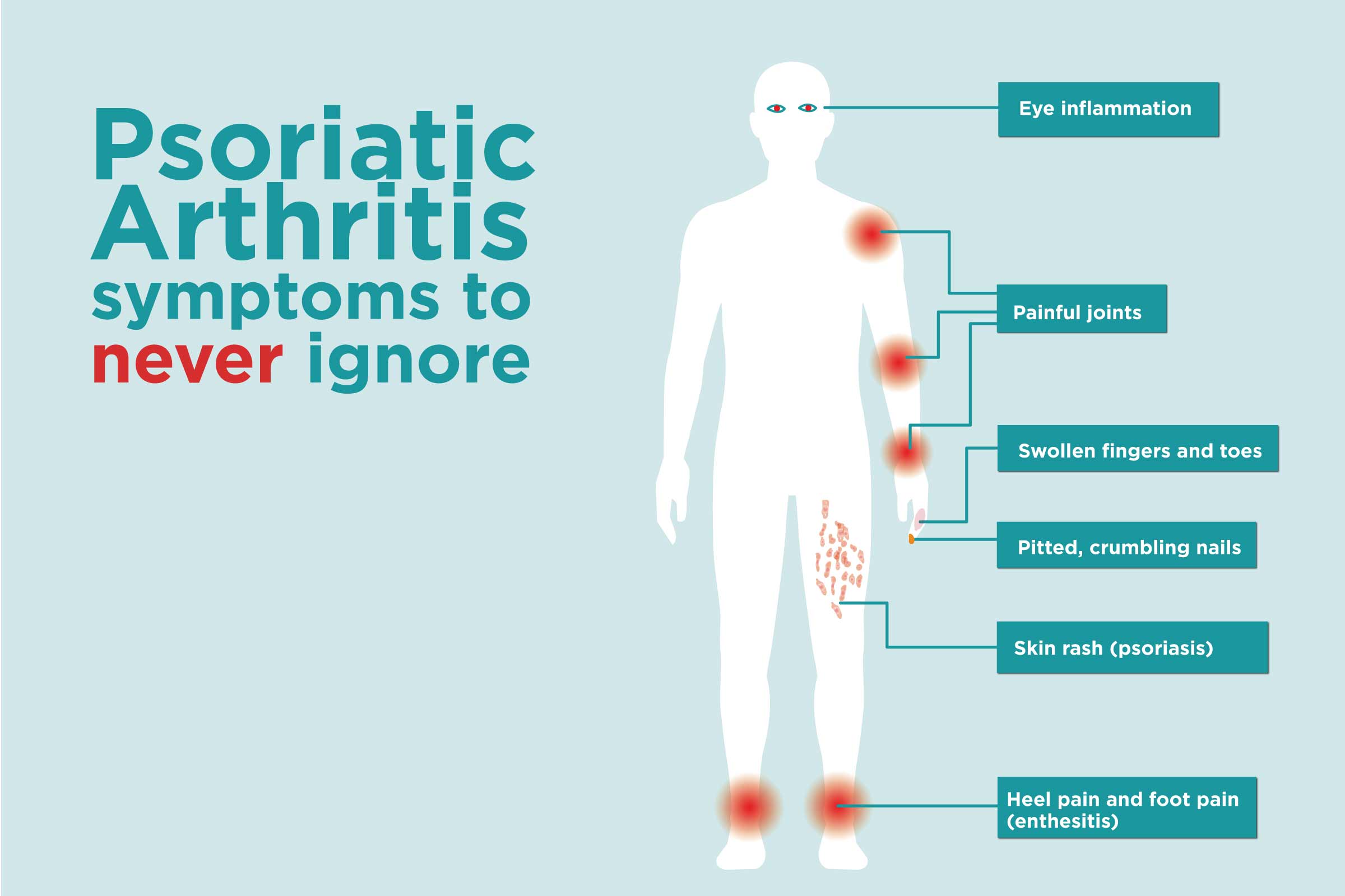 Psoriasis arthritis jelei